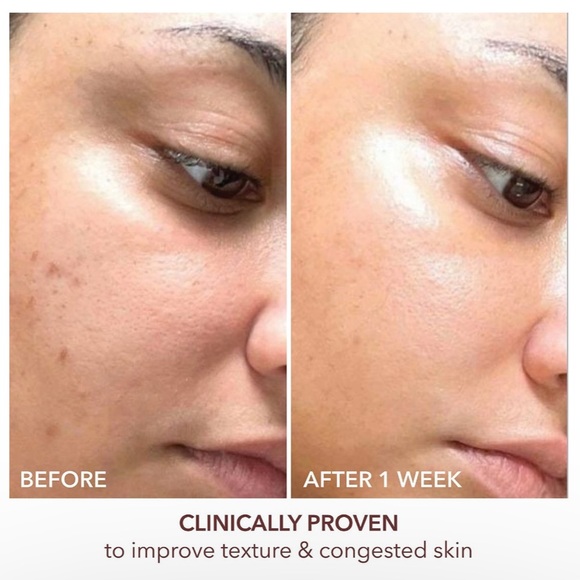 Dr. Dennis gross Texture Renewal Serum - Picture 4 of 4